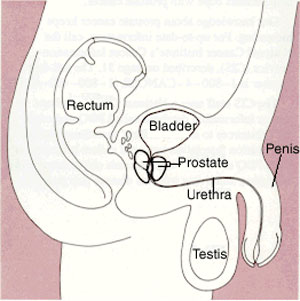 prostate laser surgery in ghaziabad